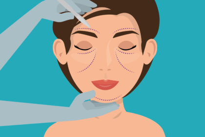 dermal fillers