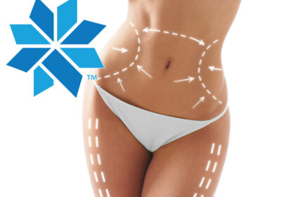 Coolsculpting