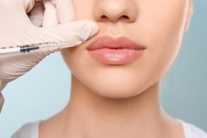 Dermal fillers