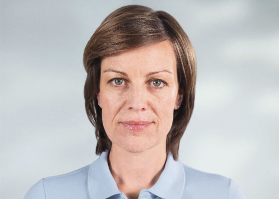 woman before her treatment