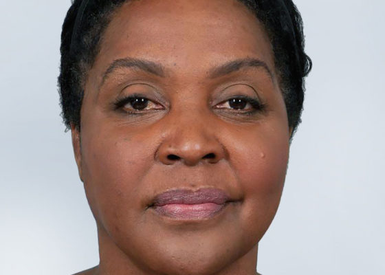 a woman with beautyfull skin