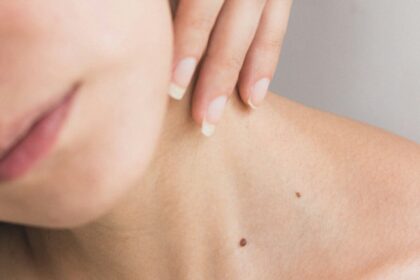 Chronic Skin