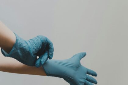 Varicose Veins