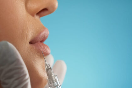 Restylane