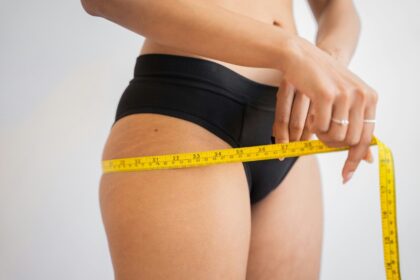 CoolSculpting