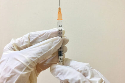 Varicose Vein