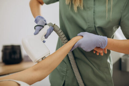 Laser hair removal