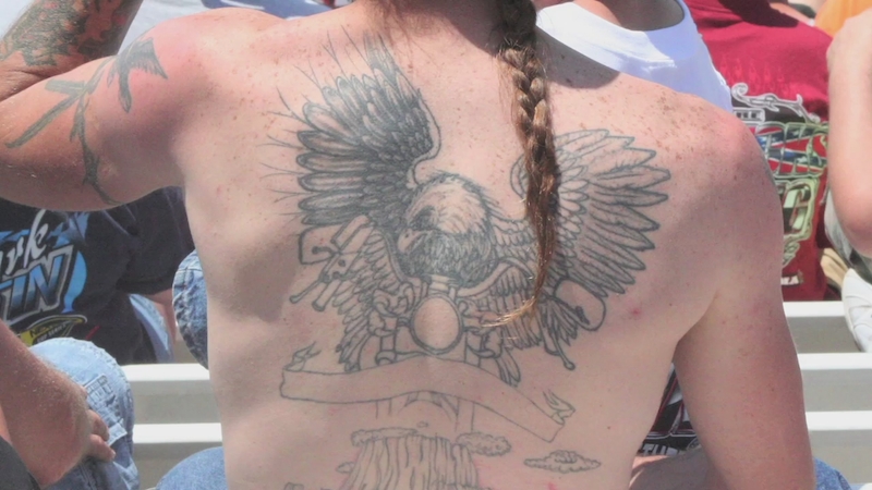 laser tatto removal