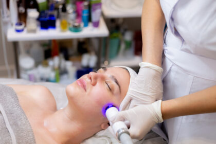 IPL photofacial